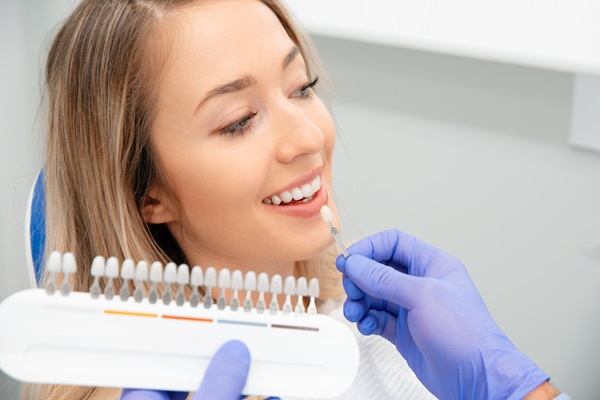 The Benefits Of Dental Veneers