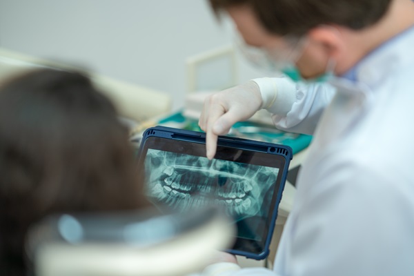 Signs You May Need A Root Canal: When To See A Dentist